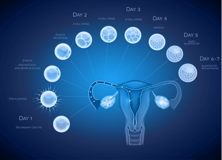 IVF Embryo Transfers: A Complete Guide